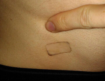 Patch Vivelledot 37,5 mg/24h Patch Vivelledot 37,5 mg/24h